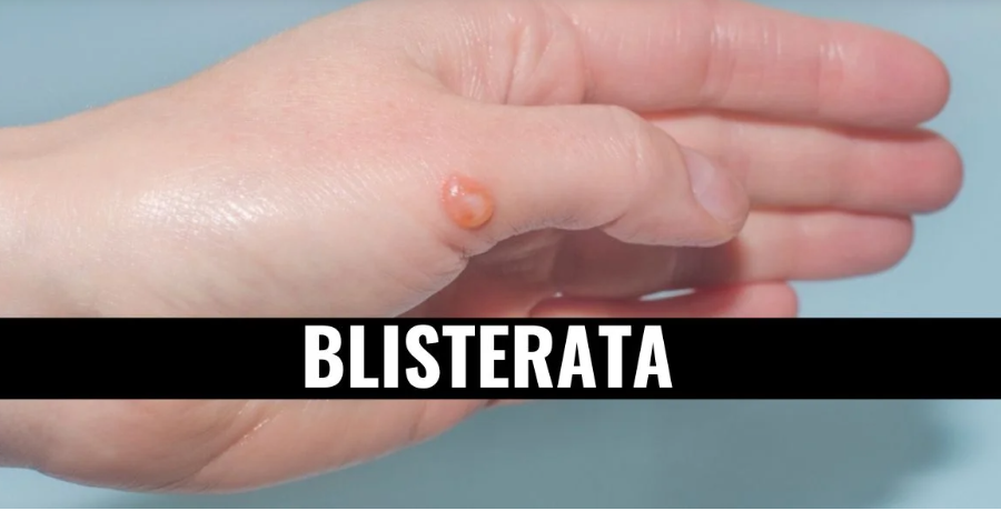 blisterata